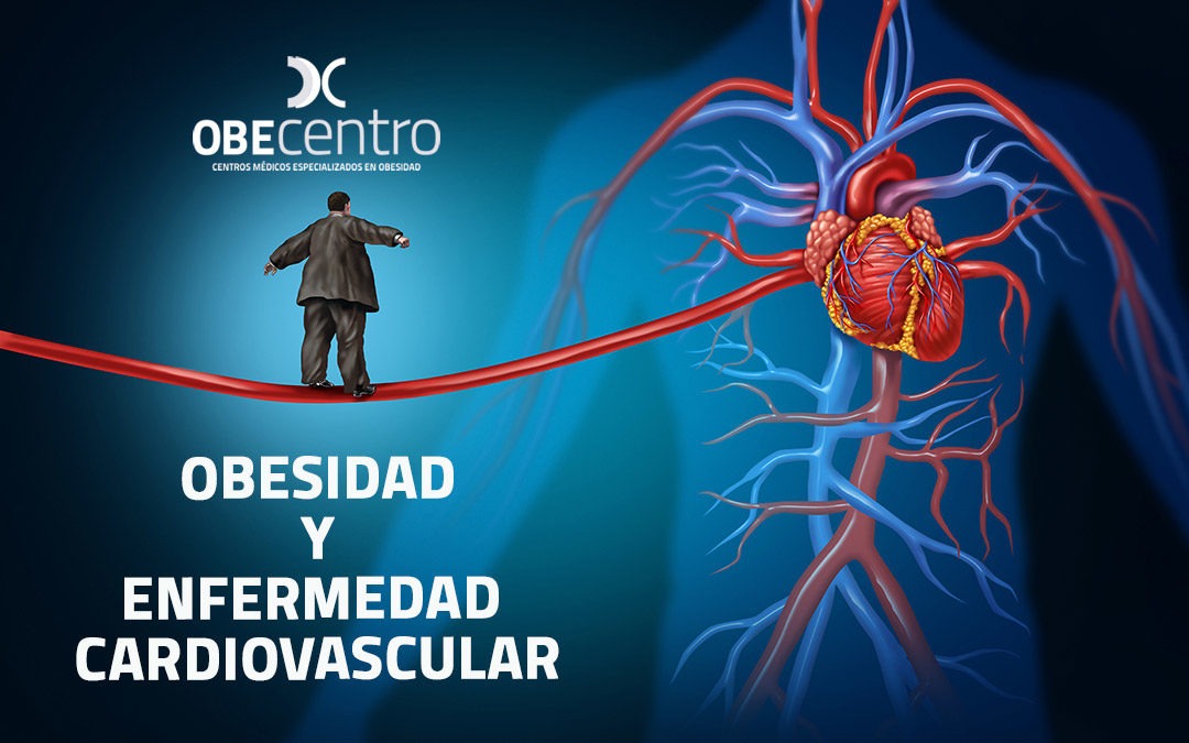 Obesidad y enfermedad cardiovascular