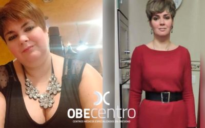 Antes y después del Sleeve Gástrico de Ainhoa