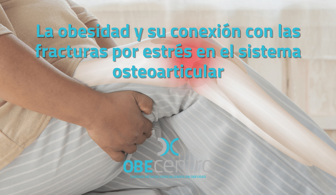 Un peso difícil de llevar: La obesidad y su conexión con las fracturas por estrés en el sistema osteoarticular